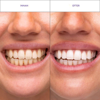 Viral hismile v-34 Whitening Strips